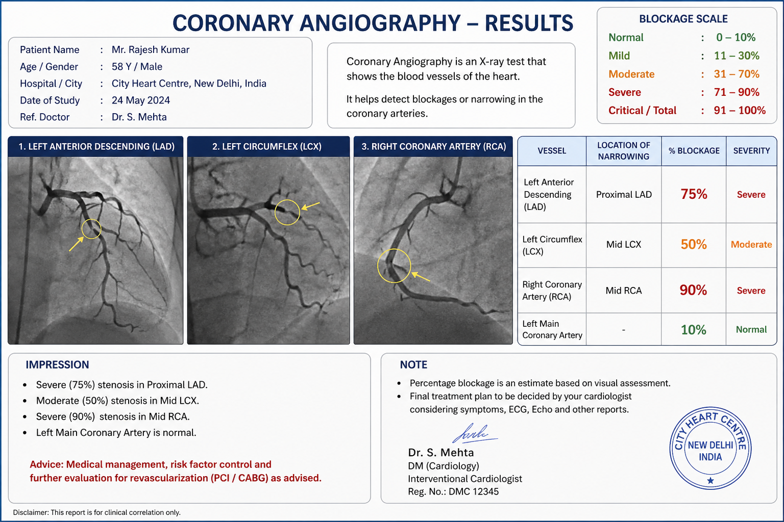 what is coronary angiography procedure results blockage percentage India