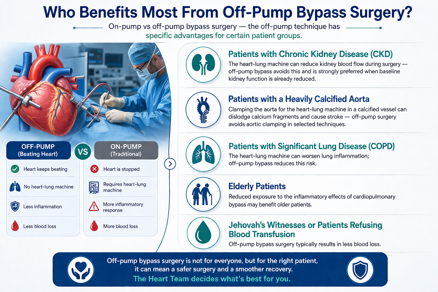  On-Pump vs Off-Pump Bypass Surgery