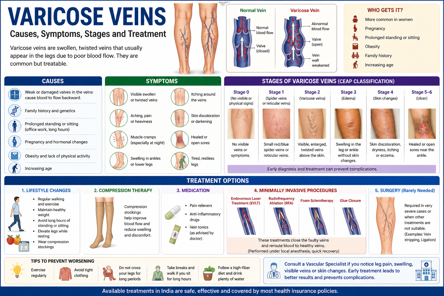 Varicose Veins — Causes, Symptoms and When They Become Dangerous