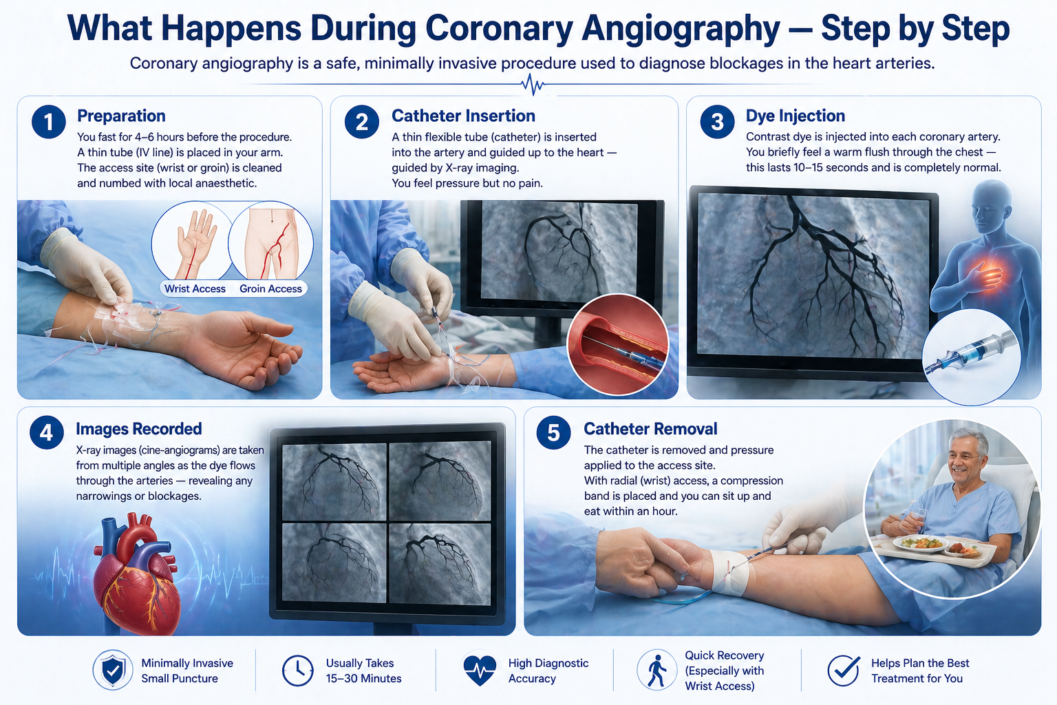  What Is Coronary Angiography