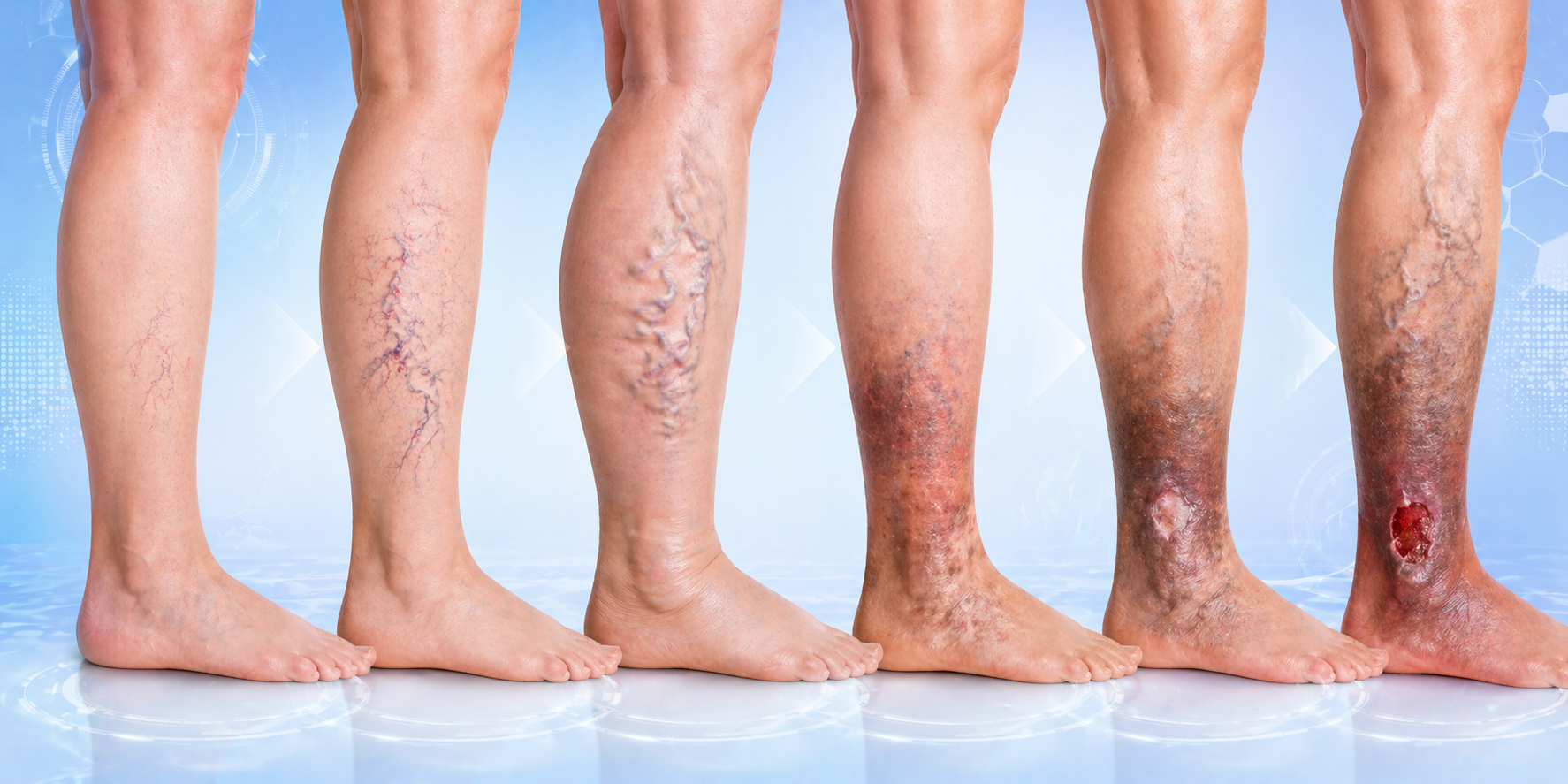 varicose veins causes symptoms
