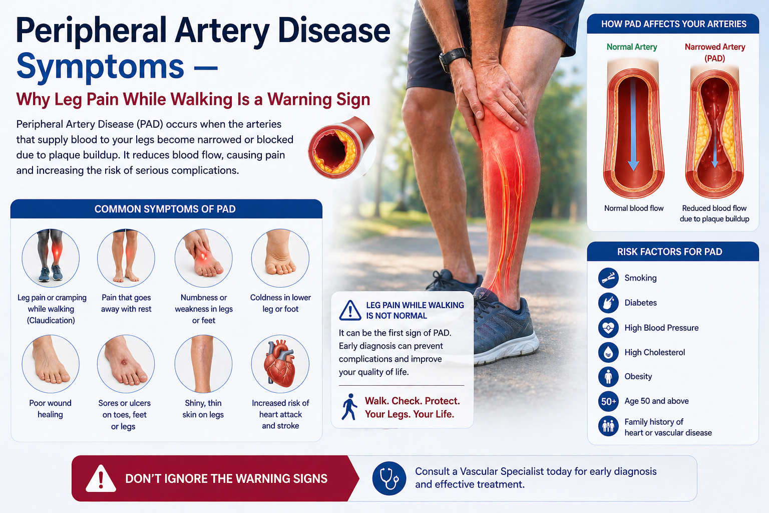   peripheral artery disease symptoms
