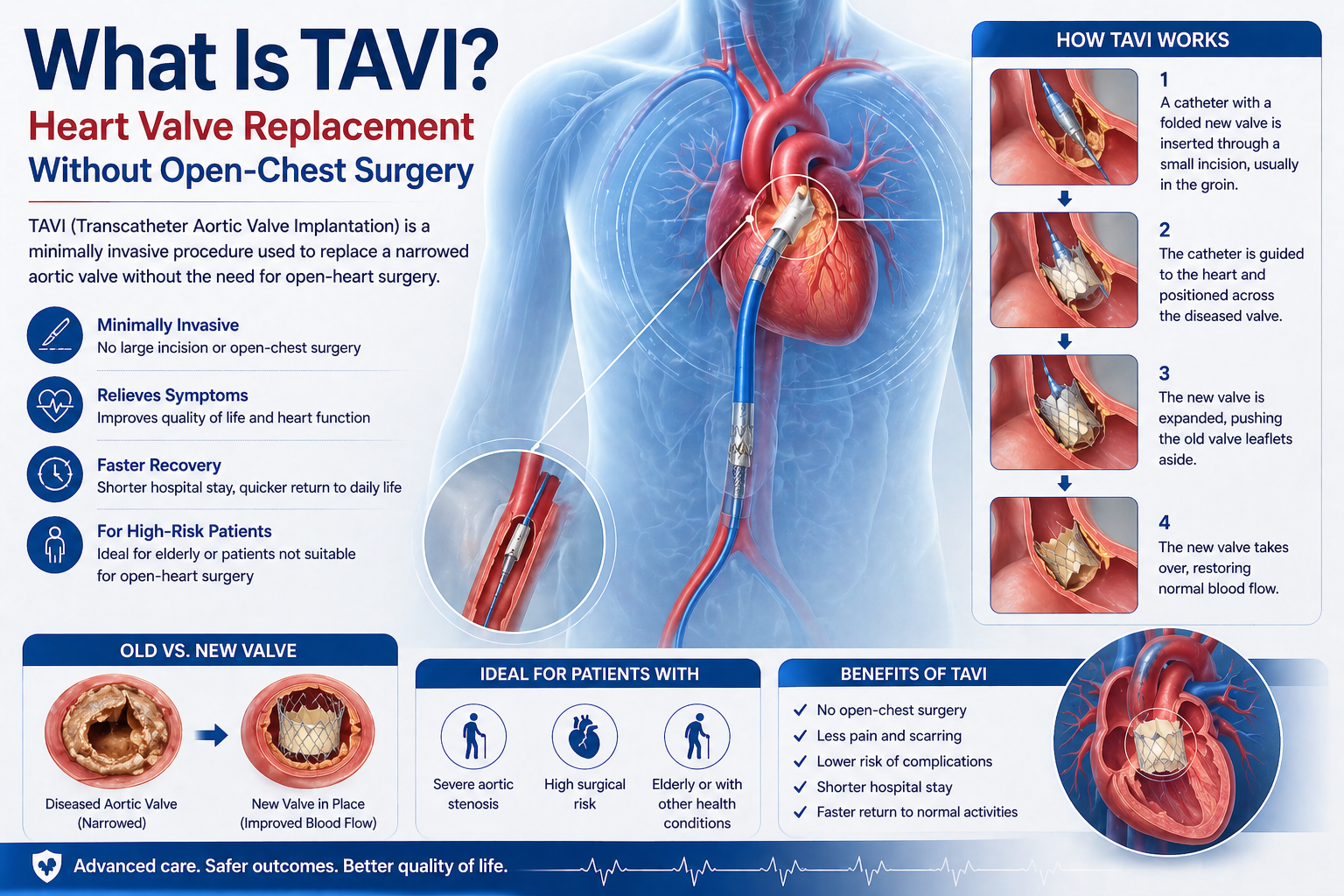 What Is TAVI
