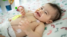 VSD in babies treatment