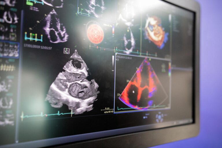 What Is an Echocardiogram? What It Shows and Why Your Doctor Ordered It