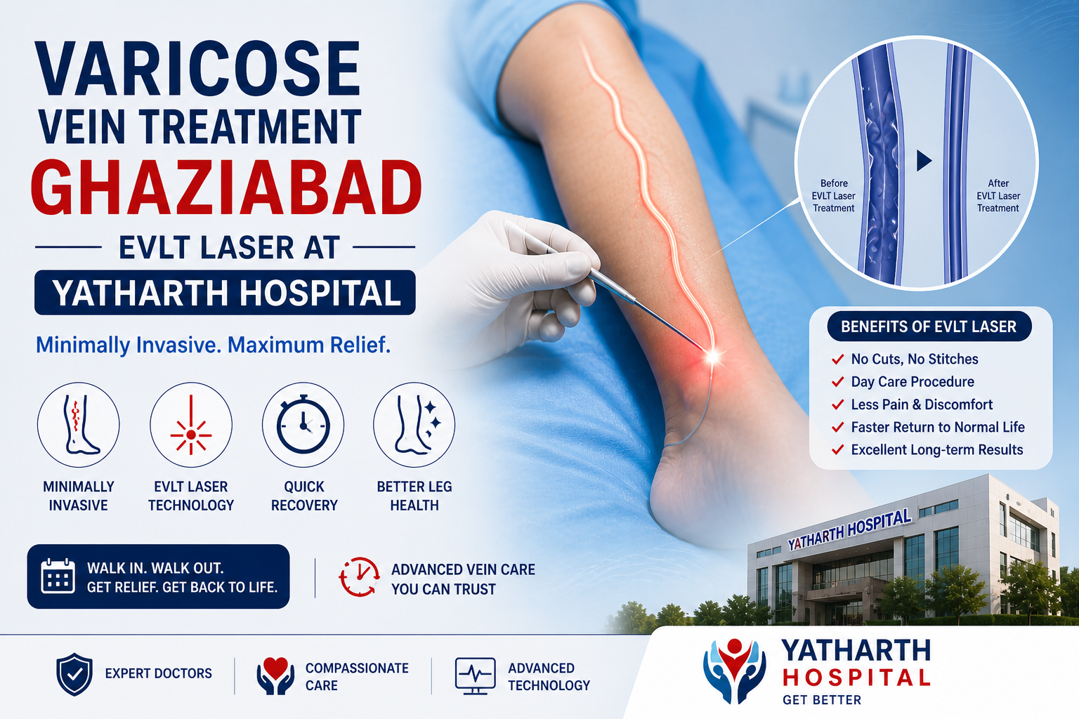  varicose vein treatment Ghaziabad

