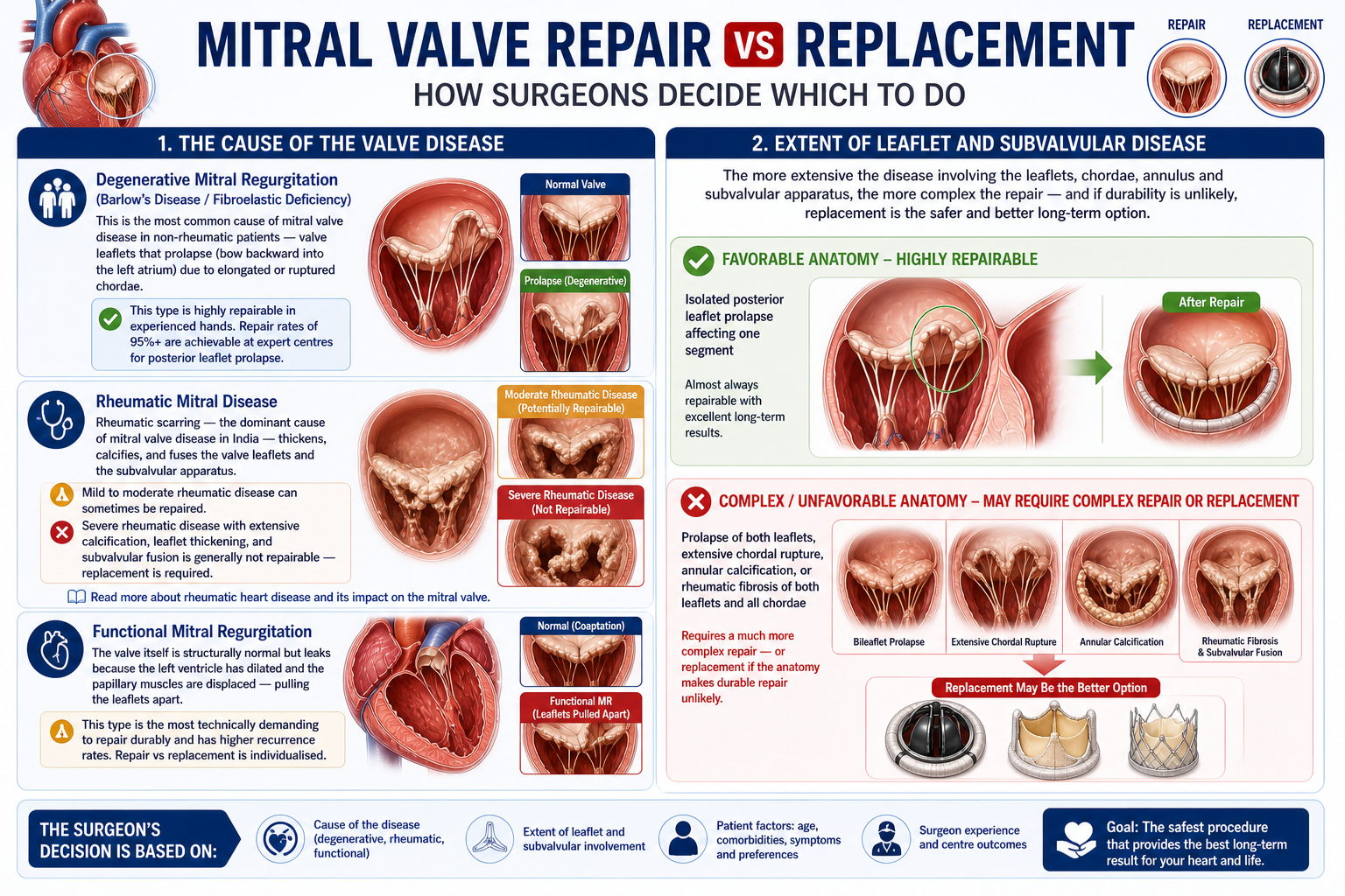 mitral valve repair vs replacement India
